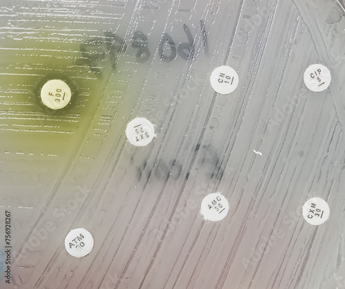 All antibiotic are resistance. Antimicrobial susceptibility testing in culture plate. Drug sensitivity test, disk drug, antibiotic sensitivity test. photo