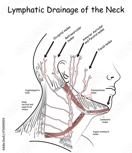 Lymphatic Drainage of the Neck, Lymphatic nodes of the Neck photo