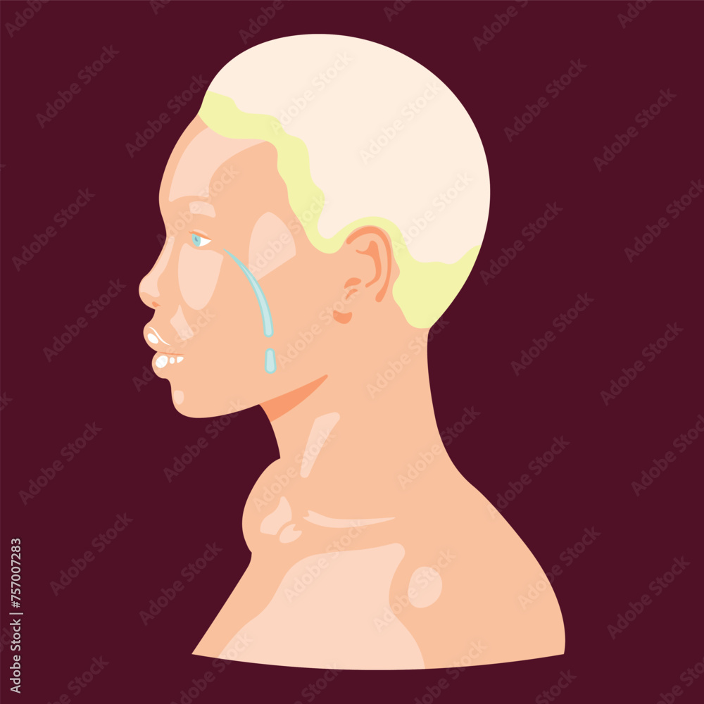 Albino girl. Head in profile with white skin and white hair. International Albinism Awareness Day. Albino African. The girl is upset and crying. Albino girl. Head in profile with white skin and white hair. International Albinism Awareness Day. Albino African. The girl is upset and crying.