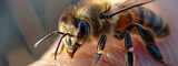bee sting close-up