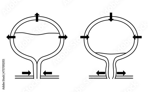 Medical Illustration of the Normal Bladder, Mechanism of Urination
