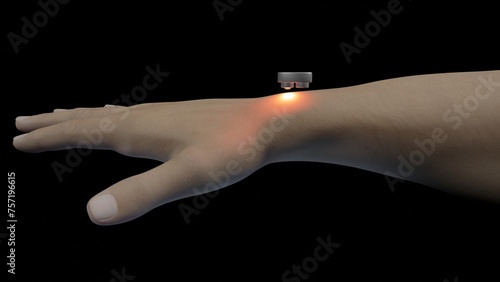 Photoplethysmography optoelectronic sensor. PPG detecting blood flow under skin.  Non-invasive biomedical monitoring technology. 3d render illustration photo