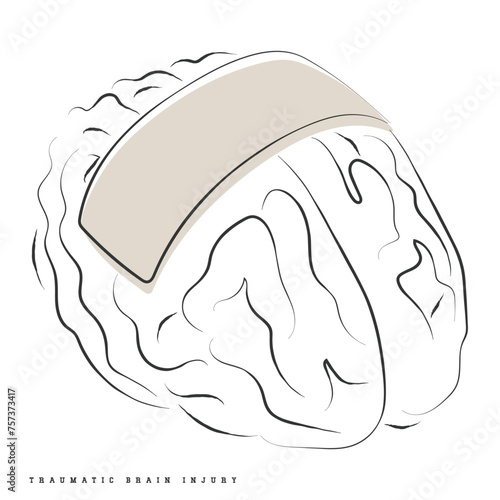 Hand drawn line art depicting Brain Injury. Traumatic Brain Injury Awareness flashcard. Concussion and Brain structure damage.