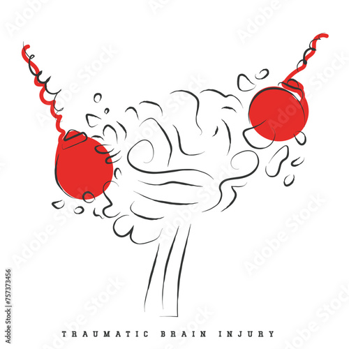 Hand drawn line art depicting Brain Injury. Traumatic Brain Injury Awareness flashcard. Concussion and Brain structure damage.