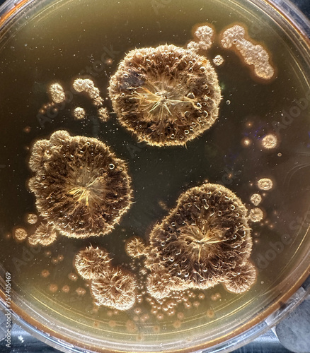Petri dish with molds, penicillium, yeast, mucor isolated on black