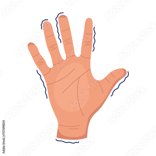 parkinson disease hand