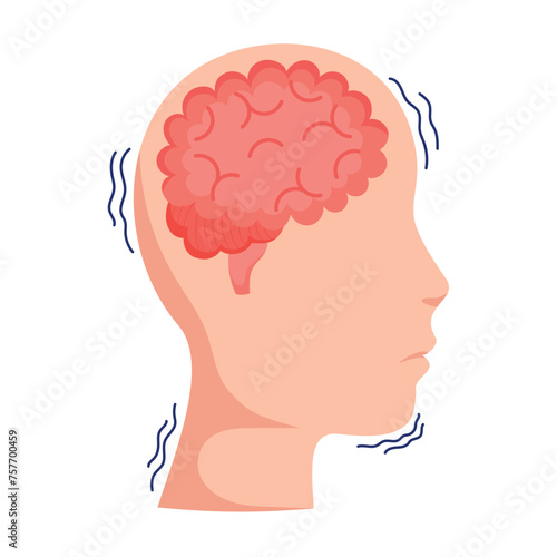 parkinson profile head shaking