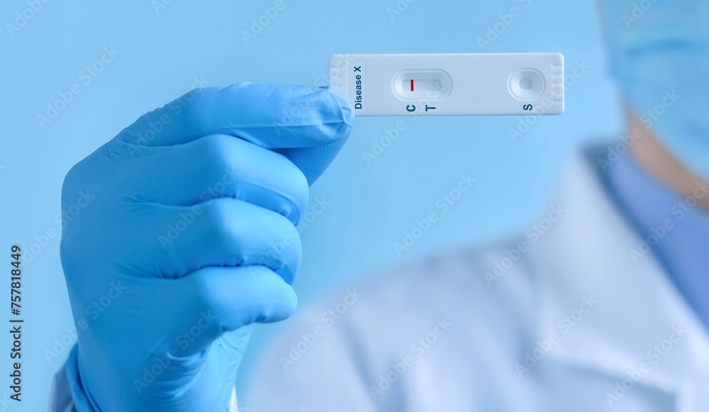 A doctor wearing a protective mask and gloves shows a rapid laboratory test for Disease X test . The test shows a negative result. Virus diagnosis, inhibition of disease outbreaks A doctor wearing a protective mask and gloves shows a rapid laboratory test for Disease X test . The test shows a negative result. Virus diagnosis, inhibition of disease outbreaks