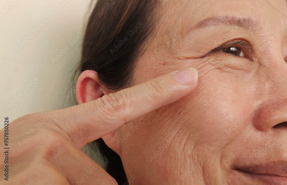 Obraz premium portrait showing the fingers holding the flabbiness and wrinkle, Flabby skin and blemish on the face of the woman, health care and beauty concept.