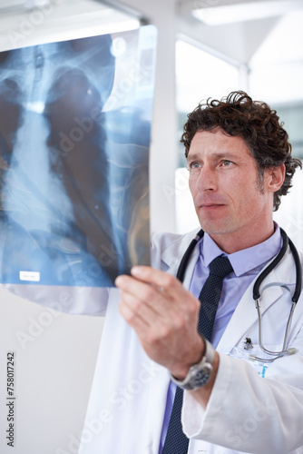 Fényképezés Doctor, man and xray in hospital to check results with thinking for lungs, decision and healthcare