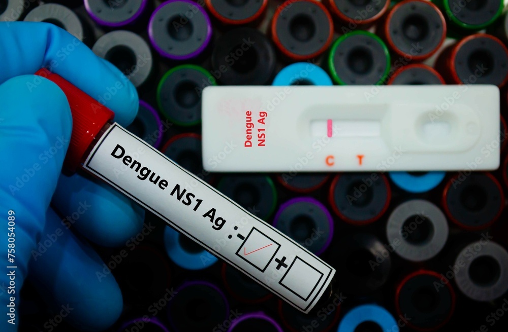Obraz premium Blood sample of patient negative tested for dengue NS1 Ag by rapid diagnostic test.