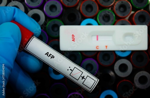 Blood sample of patient negative tested for alpha fetoprotein (AFP) by rapid diagnostic test. photo
