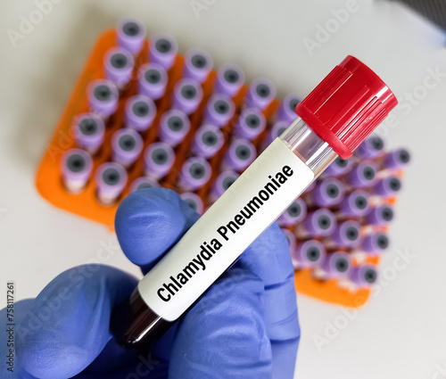 Blood sample for Chlamydia pneumoniae test. STD, STI photo