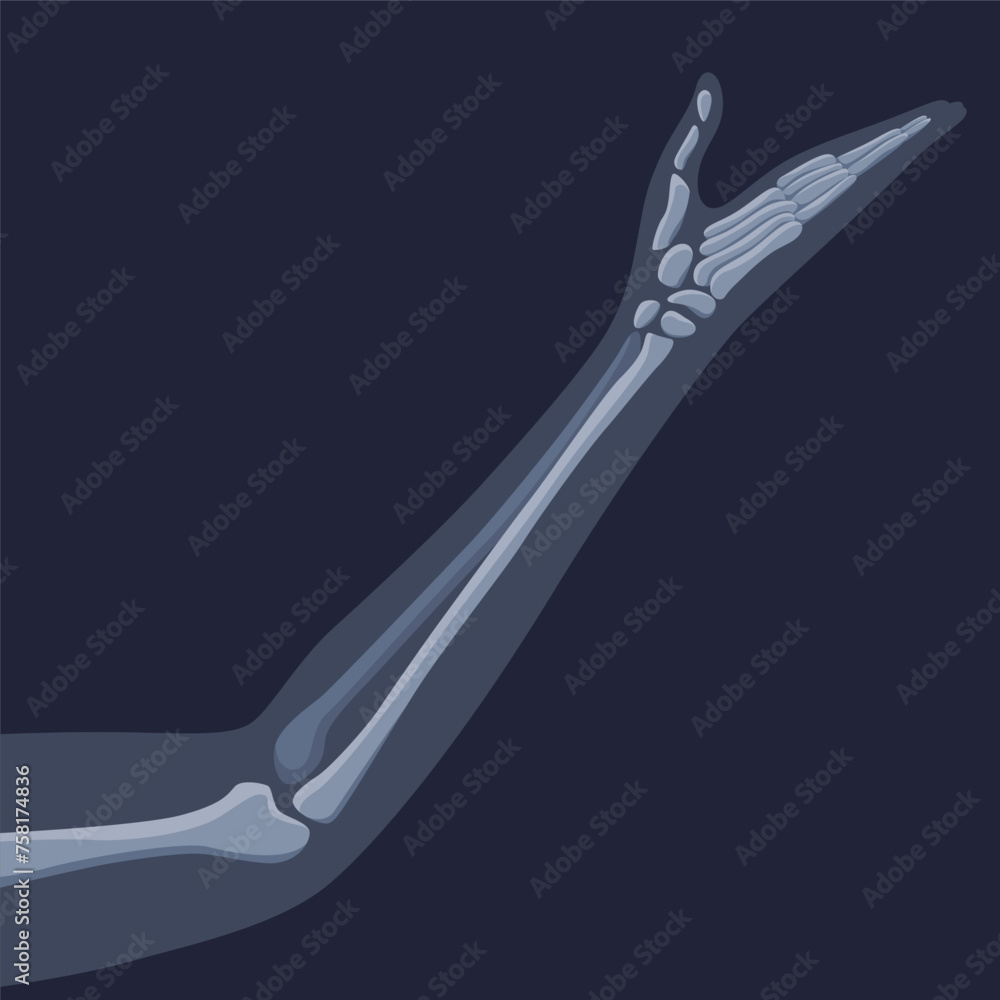 Human bones orthopedic and skeleton icon, bone x-ray image of human joints, anatomy skeleton flat design vector illustration - obrazy, fototapety, plakaty 