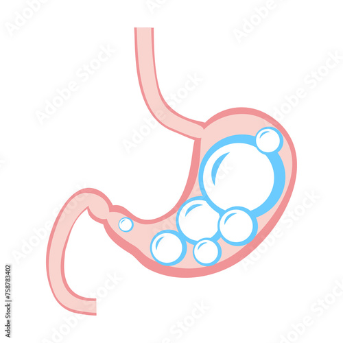 Medical illustration of Abdominal bloated stomach. Transperant ball inside stomach. Gases in stomach. Overeating problem, diabetic prevention banner design. Hunger symptom, belly disease background