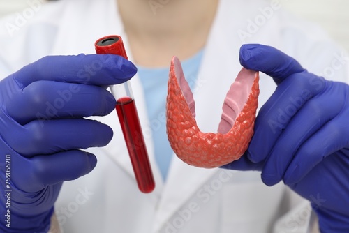 Endocrinologist showing thyroid gland model and blood sample in test tube, closeup