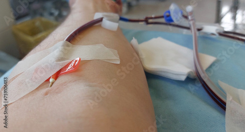 фотографія Volunteer blood donor with inserted needle in forearm