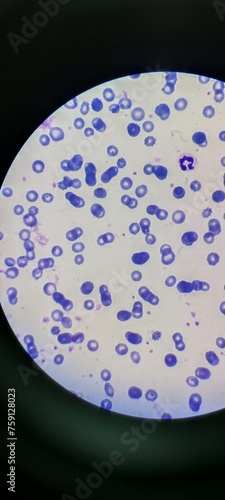 Peripheral blood film