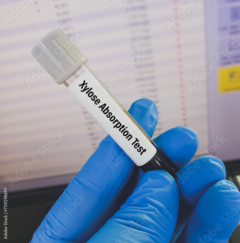 Blood sample for Xylose Absorption test, to help diagnose malabsorption disorders, that affect your ability to digest and absorb nutrients from food. xylose tolerance test, D-xylose test.