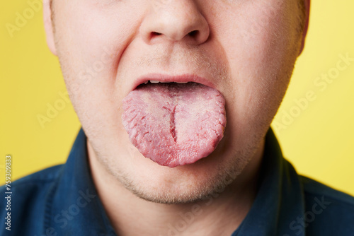 this is what your tongue says about you photo