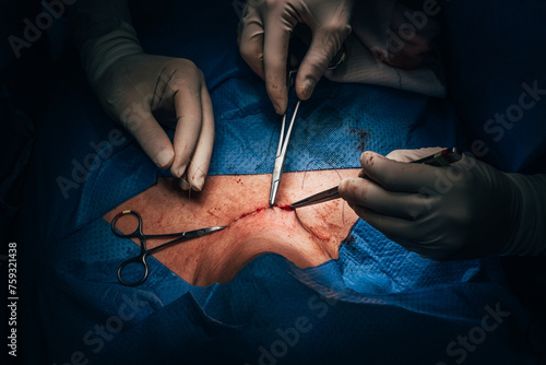 Hands of doctor stitching incision of patient in clinic photo