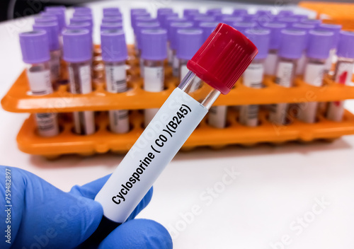 Blood sample for Cyclosporine C0 (B245) test, to determine the concentration of cyclosporine level in blood to maintain therapeutic and diagnose toxic levels. photo