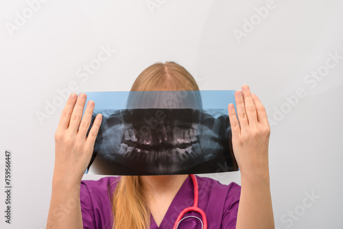 Lekarz dentysta trzyma w dłoniach prześwietlenie zębów, zdjecie pantomogram rtg