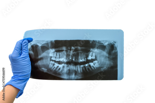 Dentysta trzyma w dłoni pantomogram panoramiczne zdjęcie zębów 