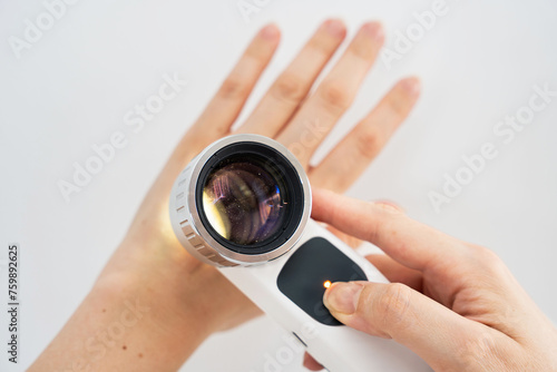 Overhead image of hands are using a dermatoscope to examine nevi (moles) on the surface of a hand against a white background showing the importance of skin examinations for early detection of melanoma photo