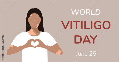 Postcard, poster in flat style. June 25 is World Vitiligo Day. Woman in white t-shirt, heart-shaped hands, skin with lost pigment. Vector illustration EPS10