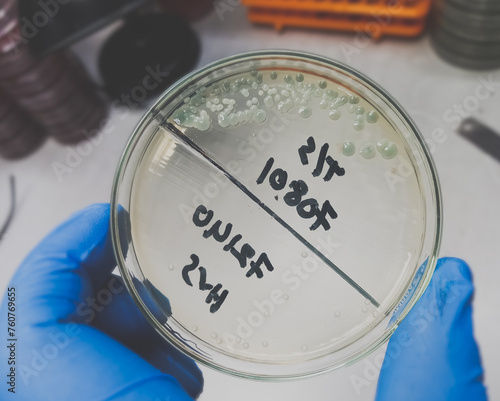 Technologist holds Bacteria culture growth on chromogenic media plate in Microbiology Laboratory, Enterococcus colony bacteria culture growth on a petri dish. photo