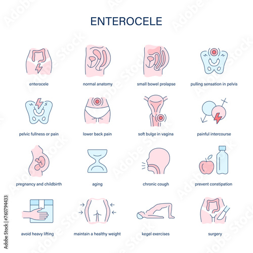 Enterocele symptoms, diagnostic and treatment vector icons. Medical icons.