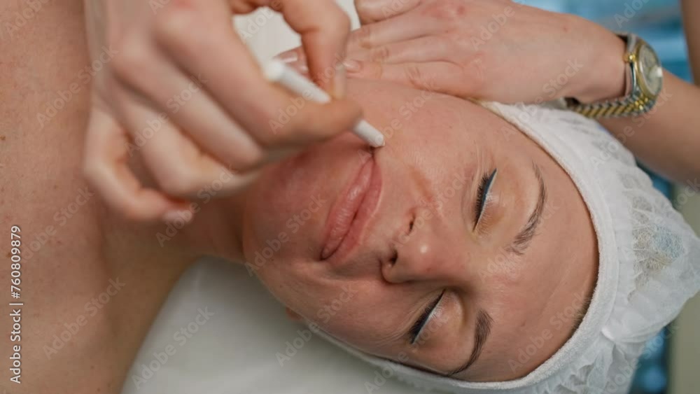 A plastic surgeon draws on a woman's face in preparation for surgery. Beauty procedures correction and change of the appearance of the skin of the face. High quality 4k footage A plastic surgeon draws on a woman's face in preparation for surgery. Beauty procedures correction and change of the appearance of the skin of the face. High quality 4k footage
