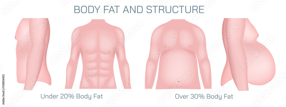 Scientifically referred to as adipocytes or adipose tissue body fat is ...