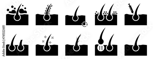 Hair Treatment and Loss Problem. Hari care, dandruff, hair fall silhouette icons collection. Isolated vector illustration.