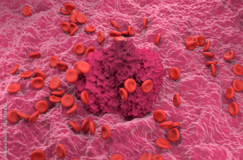 Fototapeta premium Red cells and fibrin coagulum - isometric view 3d illustration