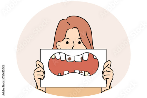 Unhappy woman with placard in hands showing unhealthy teeth. Stressed girl demonstrate teeth decay and caries. Dentistry and oralcare. Vector illustration.