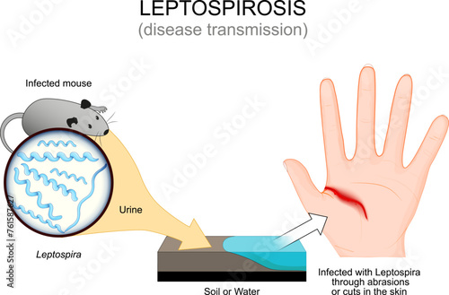 Leptospirosis. Disease transmission from Infected mouse.