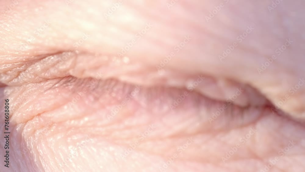 female eye mature woman, close-up wrinkles, under eye bags, swelling on lower eyelid, allergies, kidney disease, medical conditions female eye mature woman, close-up wrinkles, under eye bags, swelling on lower eyelid, allergies, kidney disease, medical conditions