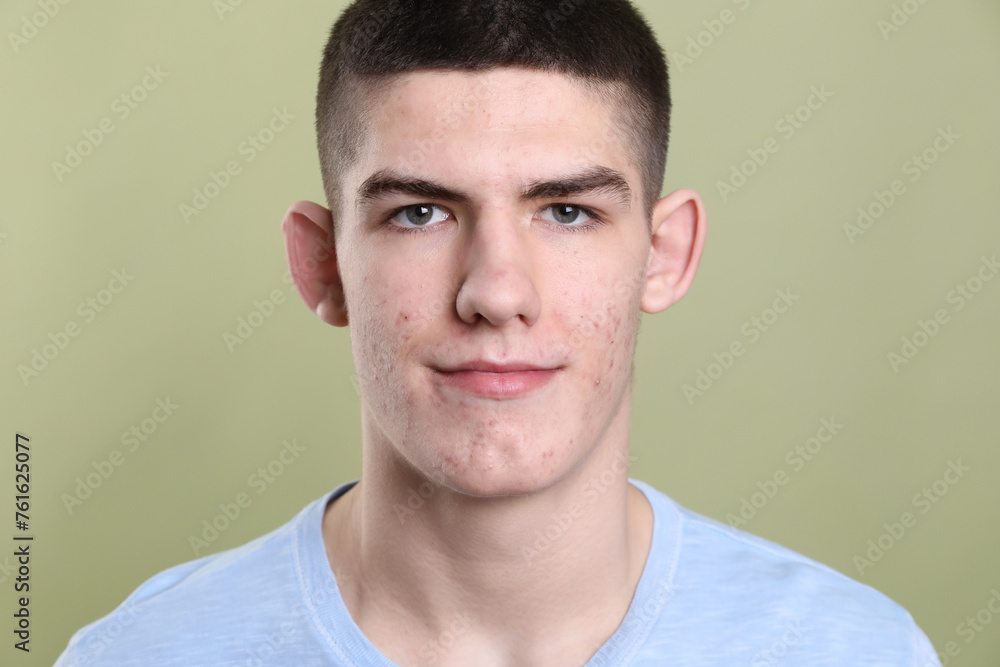 Fototapeta premium Young man with acne problem on olive background
