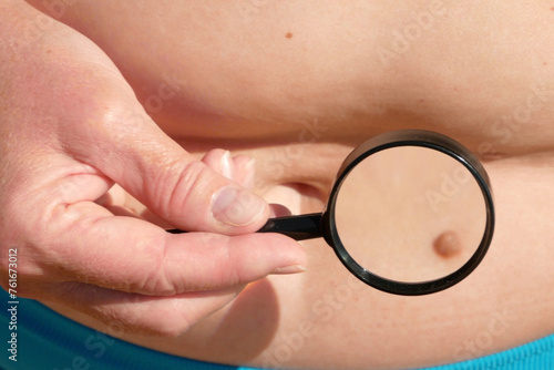 Middle-aged woman in a swimsuit on the beach checking moles on the skin, danger of sun rays for the skin, skin cancer