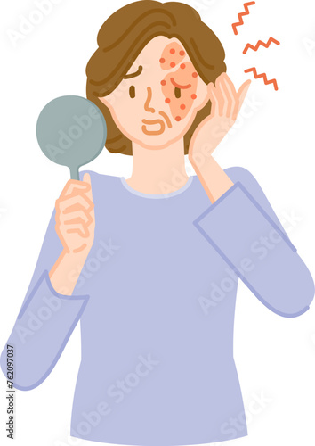 帯状疱疹：顔に痛みやかゆみ、腫れがある中年の女性