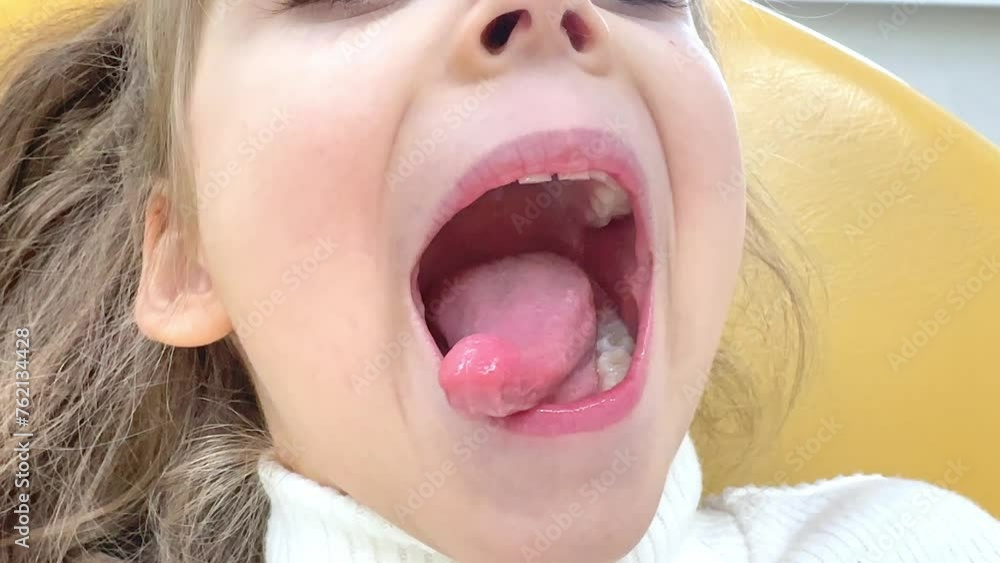 Close-up of little girl opening her mouth wide to the doctor to ...