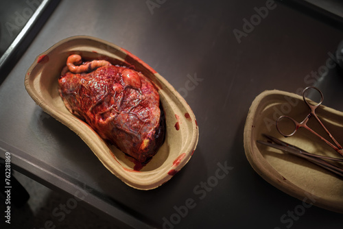 A fresh human placenta rests in its designated medical container, a vital organ of nourishment and oxygenation during pregnancy. photo