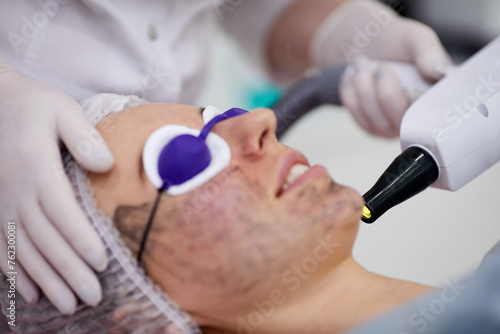 Beautician uses laser for epilate patient face in ccosmetology office  focus on laser head.