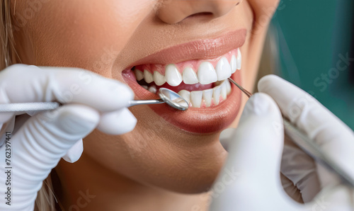 Female patient having her teeth examined by dentist. Close up. Dental clinic promotion. Teeth whitening, dental treatment, oral hygiene, treat a tooth. Smiling young woman receiving dental checkup