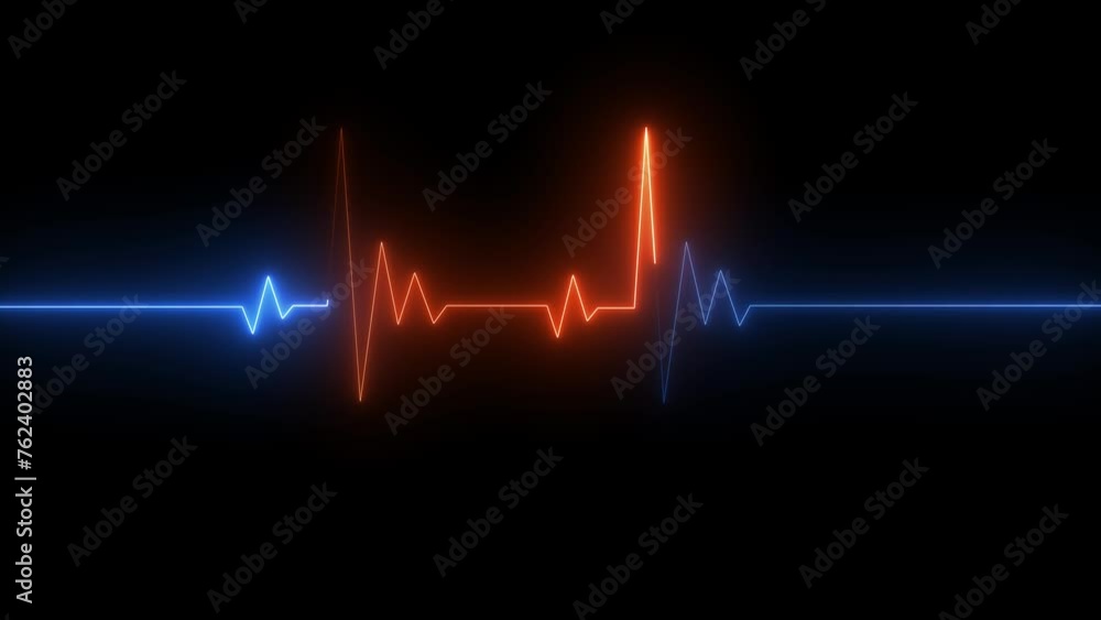 Neon Electrocardiogram Heartbeat Pulse Heart attack monitoring Medical Patient Treatment Display Background Loop Neon Electrocardiogram Heartbeat Pulse Heart attack monitoring Medical Patient Treatment Display Background Loop