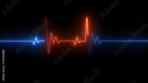 Neon Electrocardiogram Heartbeat Pulse Heart attack monitoring Medical Patient Treatment Display Background Loop
