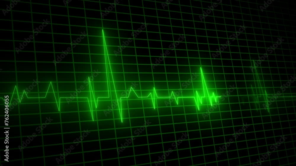 Neon Electrocardiogram Heartbeat Pulse Heart attack monitoring Medical Patient Treatment Display Background Loop. Neon Electrocardiogram Heartbeat Pulse Heart attack monitoring Medical Patient Treatment Display Background Loop.