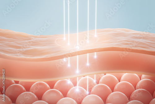Fototapeta Naklejka Na Ścianę i Meble -  Laser shot through Saggy skin cell layer, skin and Facial treatment. 3D rendering.